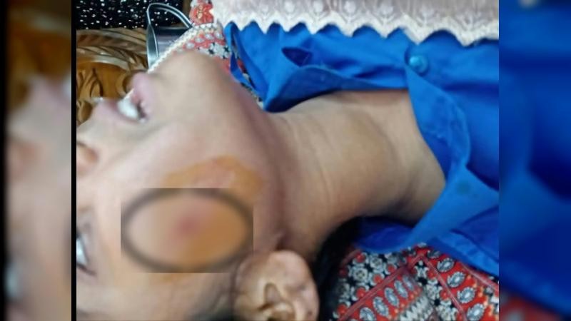 সীতাকুণ্ডে স্কুলছাত্রীকে ছুরিকাঘাত করে স্বর্ণালংকার ছিনিয়ে নেওয়ার অভিযোগ